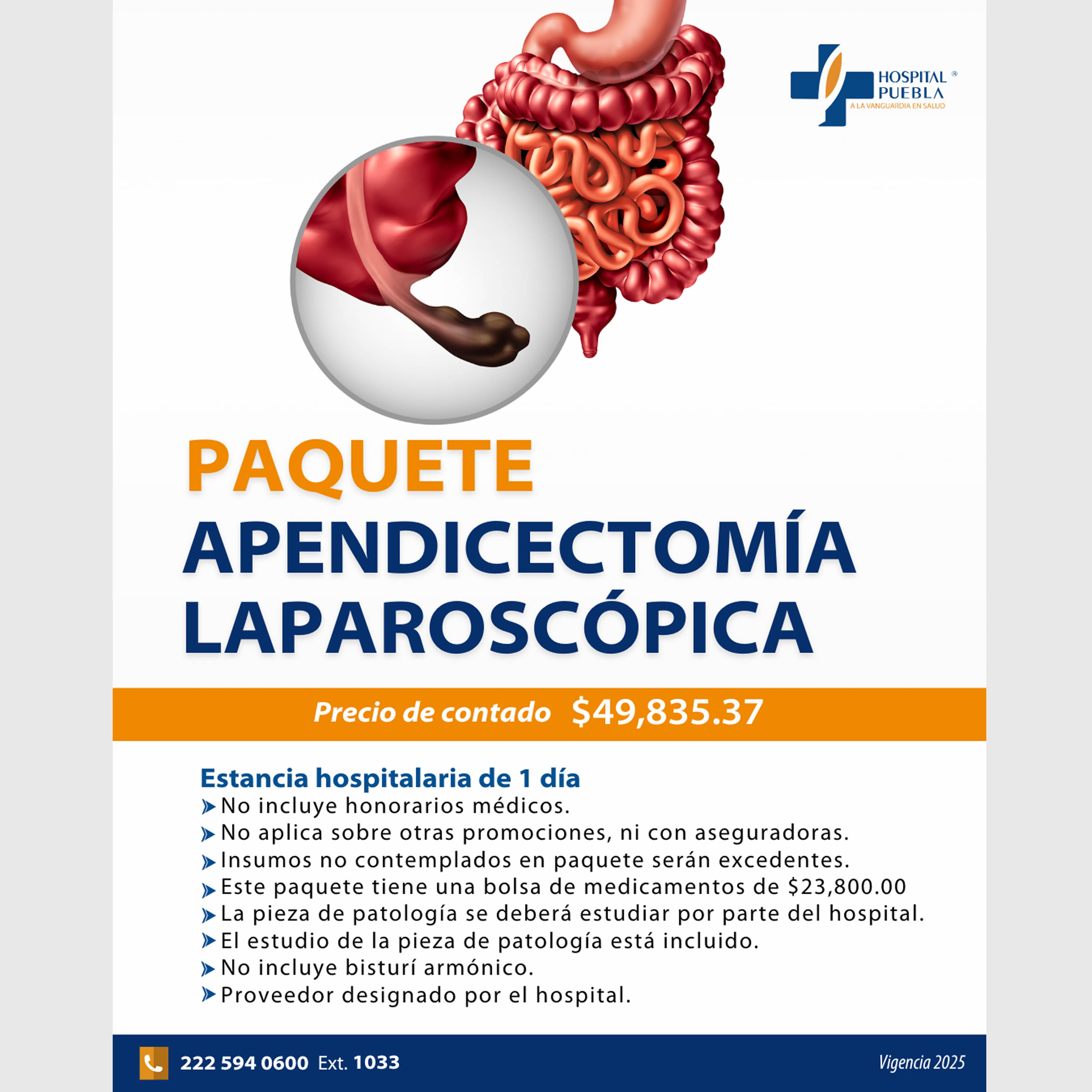 Paquete de Apendicetomía Laparoscópica